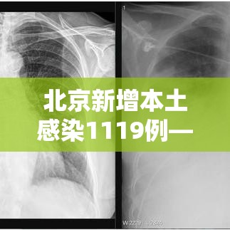 北京新增本土感染1119例—（北京新增感染病例）