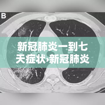 新冠肺炎一到七天症状›新冠肺炎一到七天都是什么样的症状