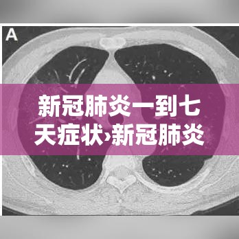 新冠肺炎一到七天症状›新冠肺炎一到七天都是什么样的症状