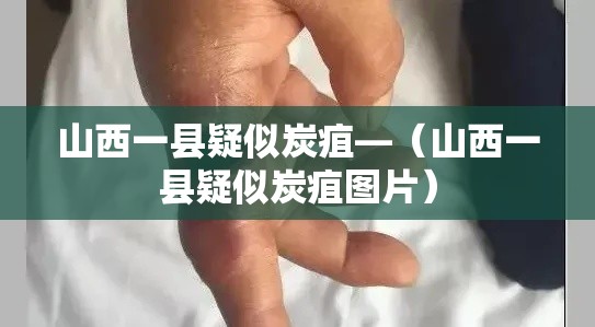 山西一县疑似炭疽—（山西一县疑似炭疽图片）