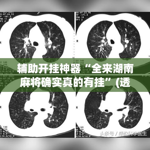 必备科技“途游四川麻将小程序有挂吗”透视开挂辅助教程
