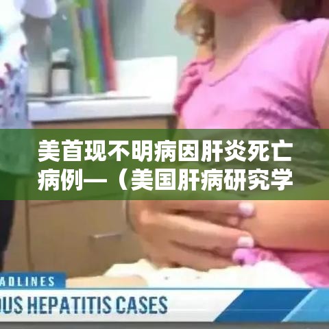美首现不明病因肝炎死亡病例—(美国肝病研究学会) 美首现不明病因肝炎死亡病例—(美国肝病研究学会)
